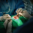 원흥역치과 임플란트 과잉 진료를 피하는 방법은?
