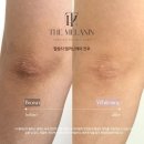 후스킨케어 네이버블로그