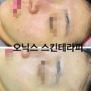 왕십리피부관리 오닉스 스킨테라피 방문 후기- 맞춤 케어로 피부부터 마음까지 힐링!
