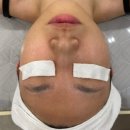미인메디에스테틱 | 아우슈라메디에스테틱 | 부천피부관리 모공클린케어 후기 🧴🫧✨