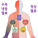 수족 냉증의 발병 원인과 병이 생기는 이유 - 1부 이미지