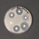 [사이언스타임즈] “항균 청결제가 항생제 내성 키워” 이미지