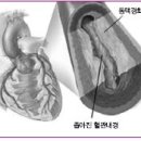 심장병의 종류 이미지