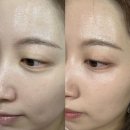 질그릇 | 시바산 발삼 비비크림 재재구매템 내돈내산 솔직리뷰ㅣ 전,후비교 다크닝후기