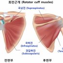 어깨통증, 어깨회전근개파열의 범위 이미지