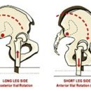 Functional Short Leg Syndrome Note 이미지