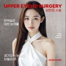 시우성형외과의원 | 처진 눈꺼풀 올리기 상안검수술 후기