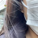 유병전내과의원 | 매복사랑니 발치 후기 | 광주 사랑니 치과 추천