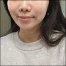 이지듀 기미쿠션 내돈내산 후기 (fast 기미앰플)