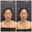 컨투어미 | [순천 윤곽관리] 컨투어미, jh윤곽술 건식 관리 후기