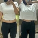 사관리 | 복부지방추출주사, 정체기 찾아왔다면? 뱃살관리 후기 및 전후사진