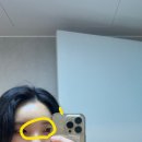 하마약국 | 광주 첨단 이마필러 내돈내산후기(+4개월지난 후기)