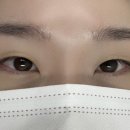 로로아로 이미지