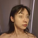 1078 | 잠실새내 피부관리 전문 핫탄스파 잠실점 4회차 재방문 비포애프터 상세솔직후기