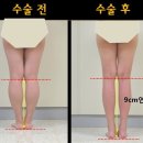 후메디앙스 이미지