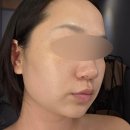 힐링 스파 | 스파더숲 광화문 직장인 웨딩 케어 추천! 프라이하우트 리커버리 힐링스파 솔직후기