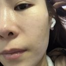 상동피부관리 물방울초음파 vdm관리 후기 봄엔뷰티 부천중동점