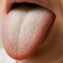 이 증상 있다면 당장 병원 가세요! 구강암 전조증상 5가지 이미지