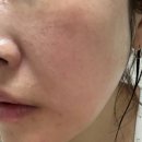 바른약국 | 피코토닝 피부장벽 EGF재생크림 지피덤 약국화장품 후기