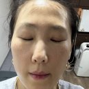 바다성형외과 | 제네시스 성형외과 후기👍