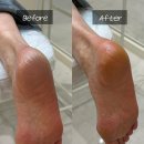 도안대로 | 대전 발각질 관리 레푸스 대전도안점 패디플래닝 후기 비용