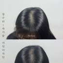 평택두피문신 가르마문신 정수리문신 헤어라인 가격 최선인곳!