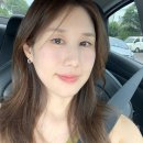 향동 | 고양향동 피부과 고현정 리프팅 텐써마 만족 후기