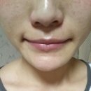 여수 마사지샵/ 피부관리 추천 - 웅천 스킨&amp;바디 * 여름철 강한 햇빛에는 수소필!!
