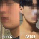 그레이트 짐 온천장 PT&헬스 | 장유PT 솔직 후기, 전역하고 몸 망가져서 시작한 그레이트짐