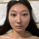 디엘르테라피