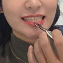 세라믹치과기공소 | 연예인치과 상담후기 강남 라미네이트 과정