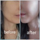 코스모과학 | 닥터코스모 엠엘크림 재생효과(1주일사용후기)