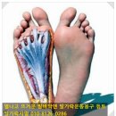 발바닥에 열나는 이유와 발바닥이 뜨거운것 해결하는법 이미지