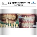 365열린치과의원 | 일산 원데이 치아미백 치료후기 365열린치과