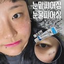 오늘또술 | 피어싱 중독자의 눈밑피어싱 눈물피어싱 일주일 후기 통증 염증 술 에스로반
