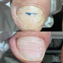 네일살롱바이선하 | 울산 문제성발 전문 네일바이선 방문 후기｜풋케어 전문샵 찾는 분들께 추천!