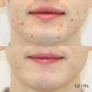 글로우의원 이미지