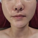 김포 운양동피부관리 리에주 스킨&amp;왁싱에서 피부재생관리 후기