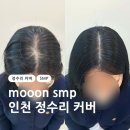 에스엠 | mooon smp 문에스엠피｜인천 부평 정수리커버 찐 후기(전/후 사진)
