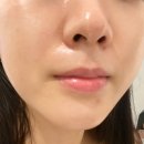 용인 고림, 둔전 피부관리 - 수가인뷰티 용인둔전점에서 미백관리 받았어요 :)