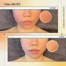 고은솔루션 이미지