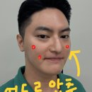 천안스노우의원 | 천안여드름압출 후기 말고 현실적인 기준 3가지