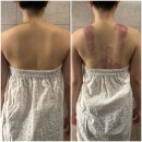 노원윤곽관리 잘하는 아리아뷰티 파워트리 케어 후기