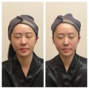 서면 윤곽관리 에스테틱 카리언뷰티클리닉 후기
