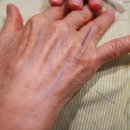 올마디한의원 | 대구 특발성(퇴행성) 또는 혈관성 파킨슨병에 체질 중점 한의원의 효율적 치료는?