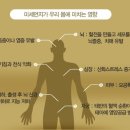 크린시스 이미지