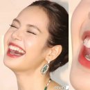 닥터박고은치과의원 네이버블로그