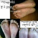 케이커스트 이미지