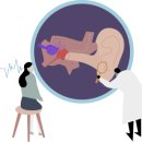 소리샘보청기 이미지