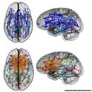 남과 녀 뇌구조 차이? 이미지